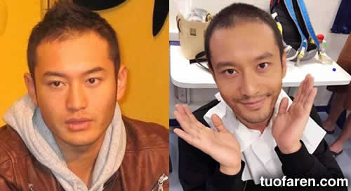 黄晓明发际线后移照片