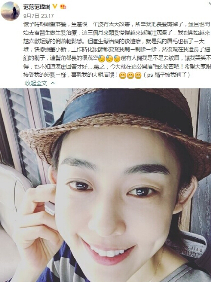 范玮琪2015年产后脱发
