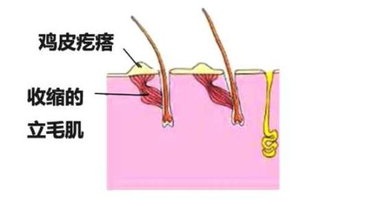立毛肌
