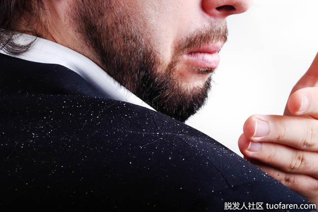 迷迭香发油可能对治疗头皮屑有帮助