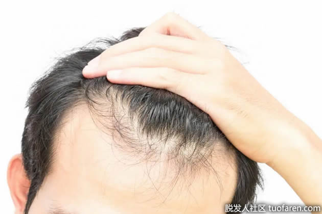 洋葱汁的作用