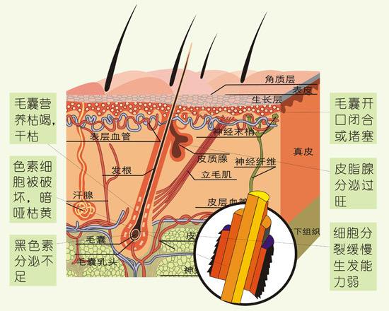 毛囊结构图