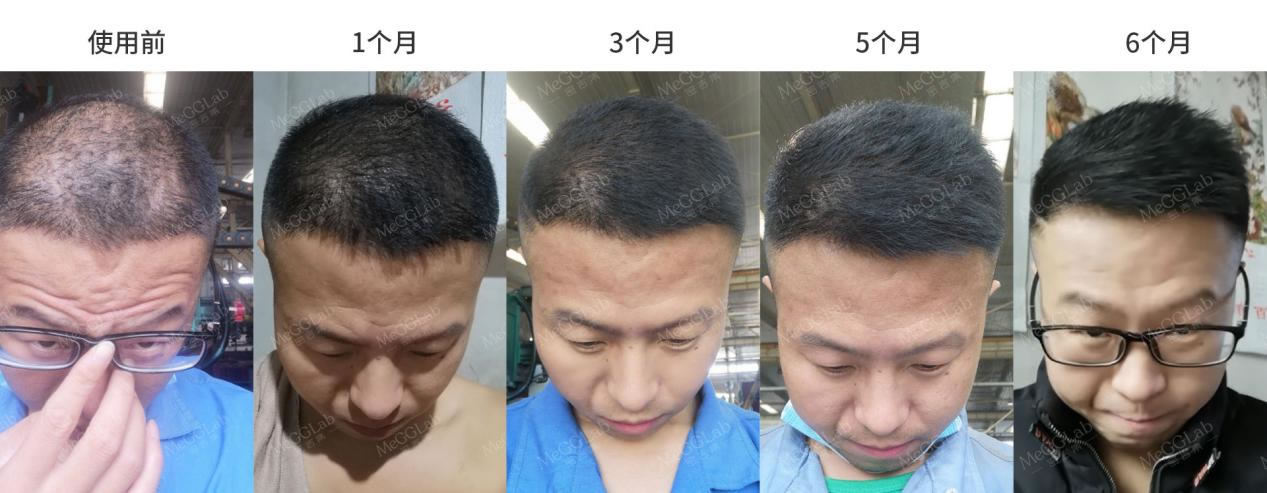米诺增效_效果图1