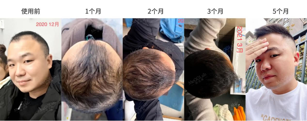 米诺增效_效果图2