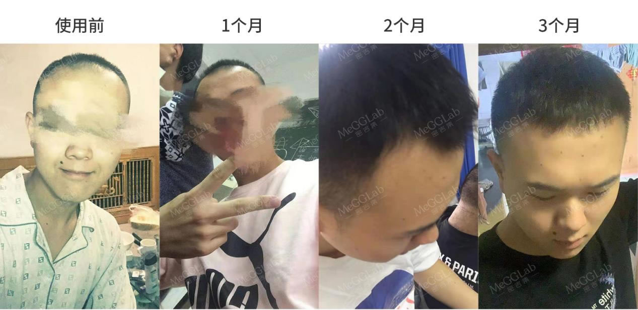 米诺增效_效果图3