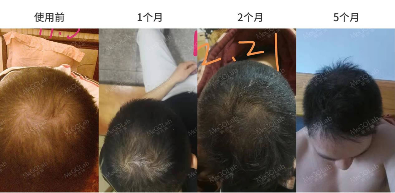 米诺增效_效果图4