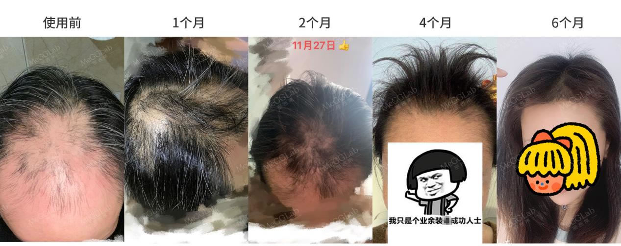 米诺增效_效果图5