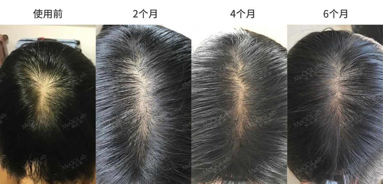 米诺增效_效果图6