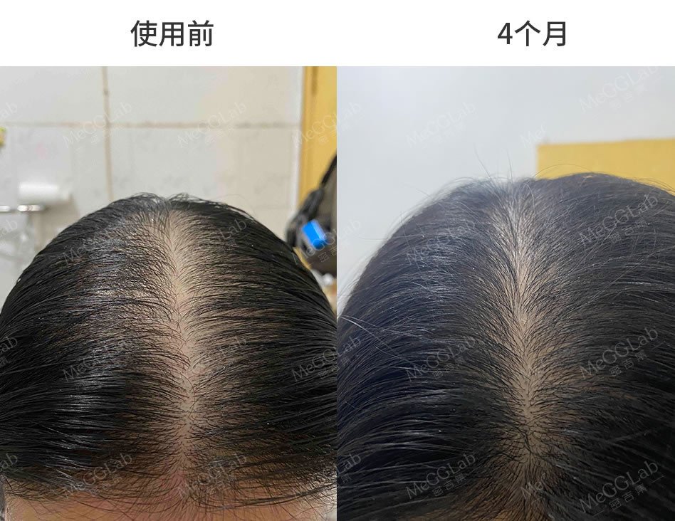 米诺增效_效果图7