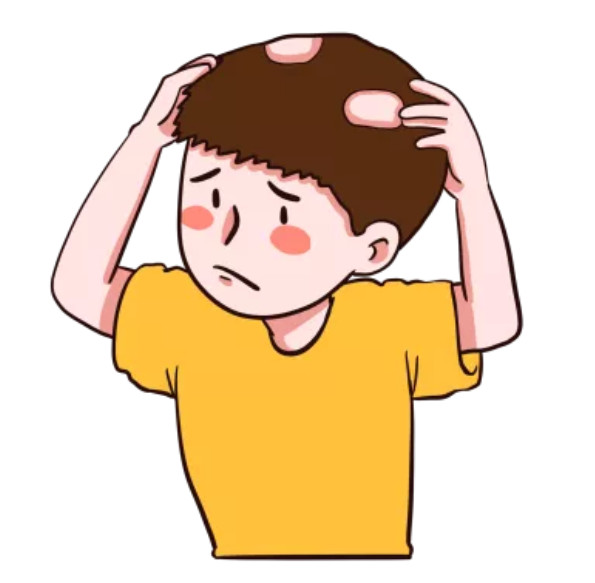 脱发卡通图2