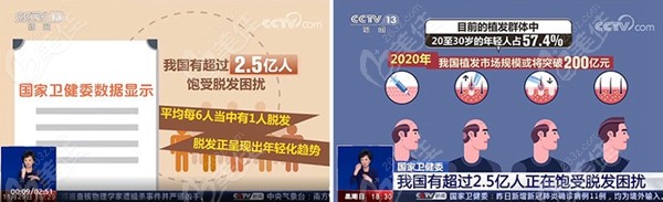 国内脱发人群比例