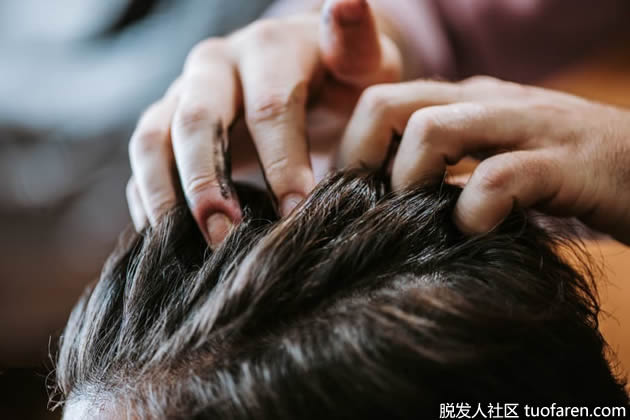 如何治疗发蜡引起的脱发