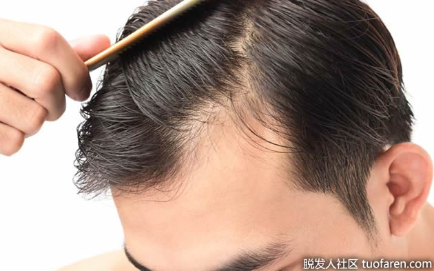 吸烟是如何导致脱发的?