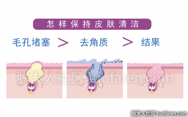 怎样清洁皮肤