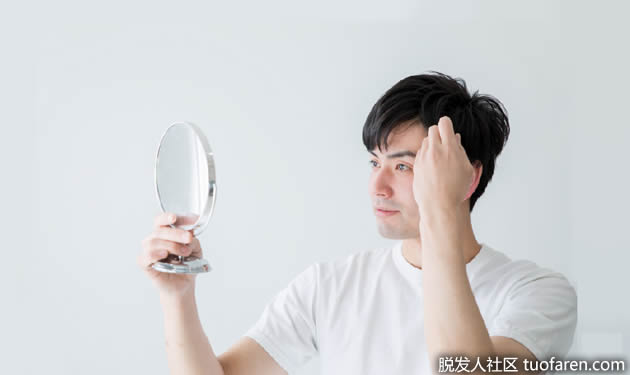 需要植发的年轻人有哪些特征?