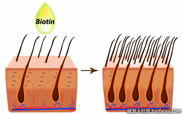 维生素治疗脱发毛发生物素皮脂溢出