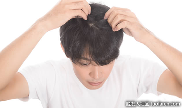 头皮保养